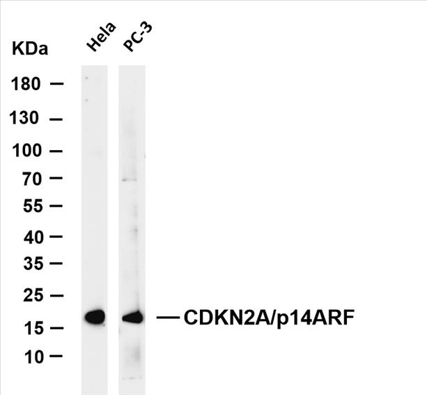 Various whole cell lysates were separated by 4-20% SDS-PAGE, and the membrane was blotted with anti-CDKN2A/p14ARF (PT0154R) antibody. The HRP-conjugated Goat anti-Rabbit IgG(H + L) antibody was used to detect the antibody.