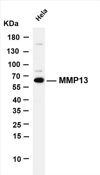 Various whole cell lysates were separated by 4-20% SDS-PAGE, and the membrane was blotted with anti-MMP13 (PT0161R) antibody. The HRP-conjugated Goat anti-Rabbit IgG(H + L) antibody was used to detect the antibody.