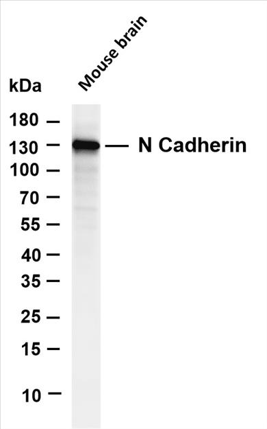 Various whole cell lysates were separated by 4-20% SDS-PAGE, and the membrane was blotted with anti-N Cadherin (PT0163R) antibody. The HRP-conjugated Goat anti-Rabbit IgG(H + L) antibody was used to detect the antibody.