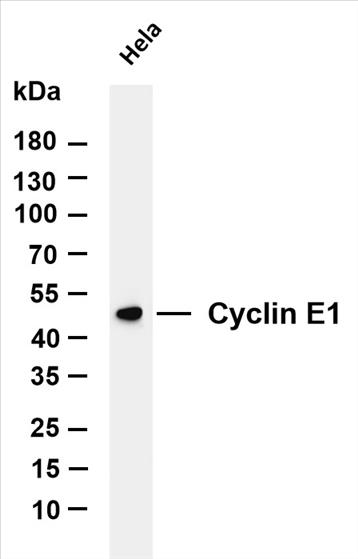 Various whole cell lysates were separated by 4-20% SDS-PAGE, and the membrane was blotted with anti-Cyclin E1(PT0164R) antibody. The HRP-conjugated Goat anti-Rabbit IgG(H + L) antibody was used to detect the antibody.