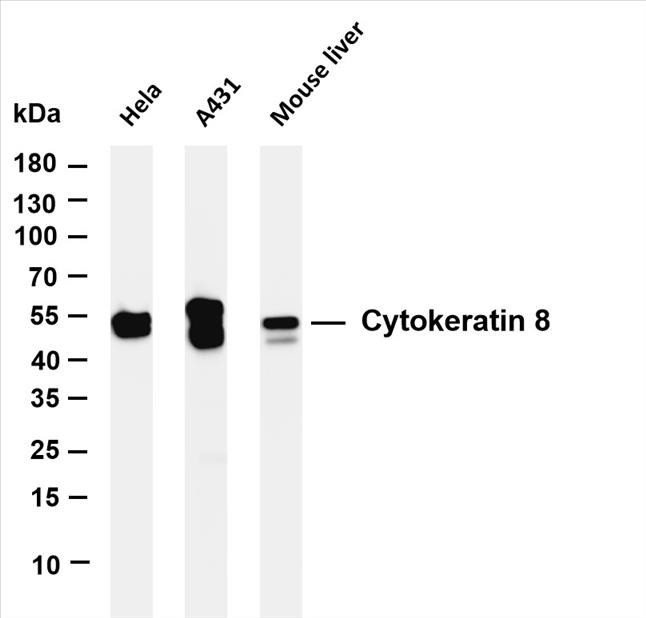 Various whole cell lysates were separated by 4-20% SDS-PAGE, and the membrane was blotted with anti-Cytokeratin 8 (PT0166R) antibody. The HRP-conjugated Goat anti-Rabbit IgG(H + L) antibody was used to detect the antibody.