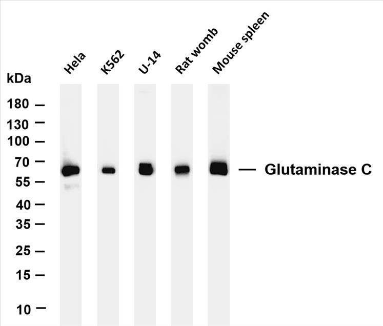 Various whole cell lysates were separated by 4-20% SDS-PAGE, and the membrane was blotted with anti-Glutaminase C (PT0168R) antibody. The HRP-conjugated Goat anti-Rabbit IgG(H + L) antibody was used to detect the antibody.