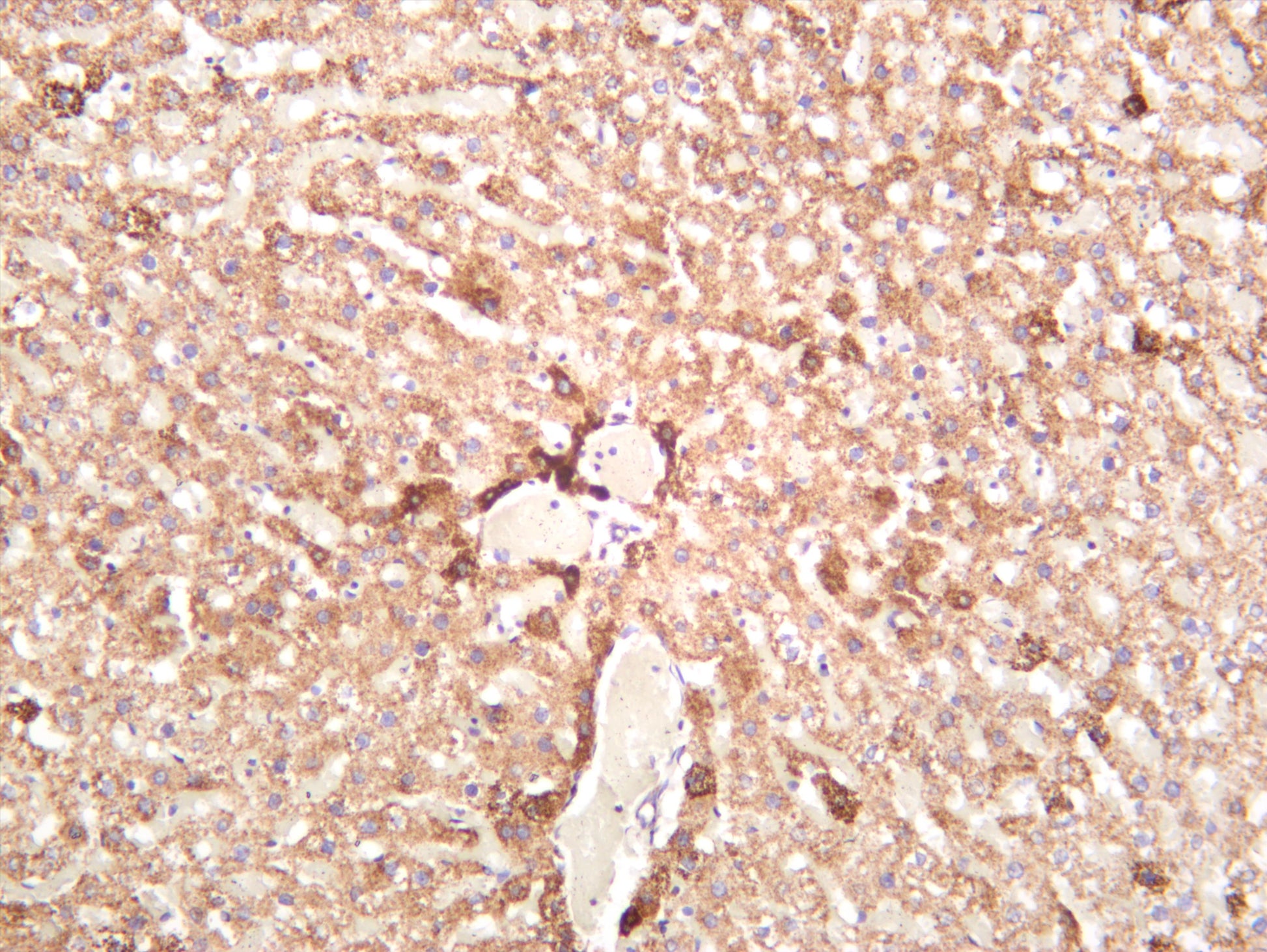 Rat liver was stained with anti-ATPB (PT0169R) rabbit antibody