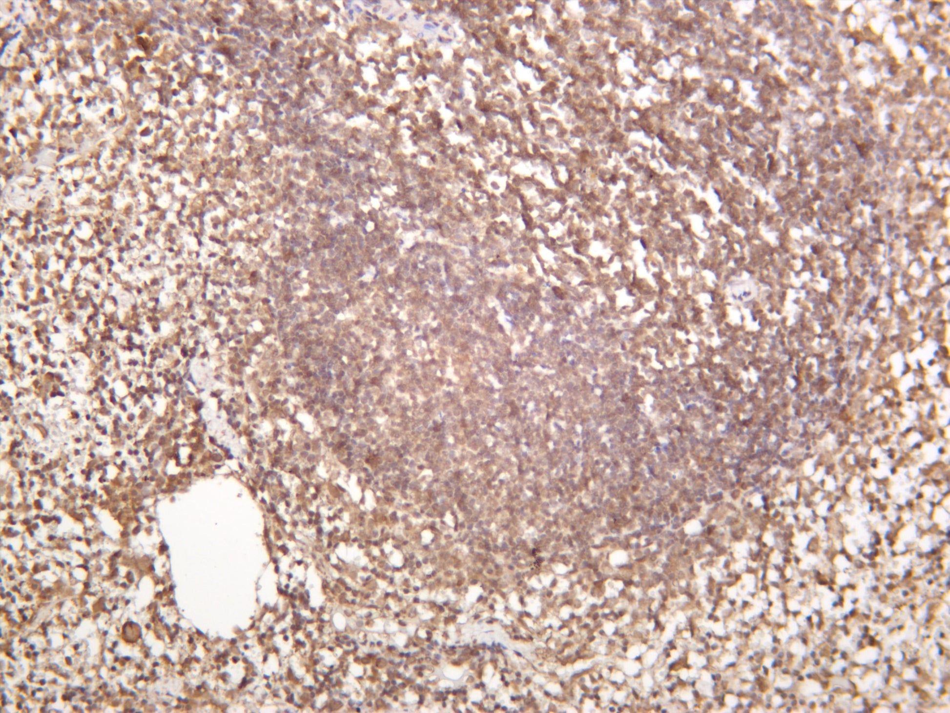 Mouse spleen was stained with anti-Stromal Interaction Molecule 1 (PT0172R) rabbit antibody