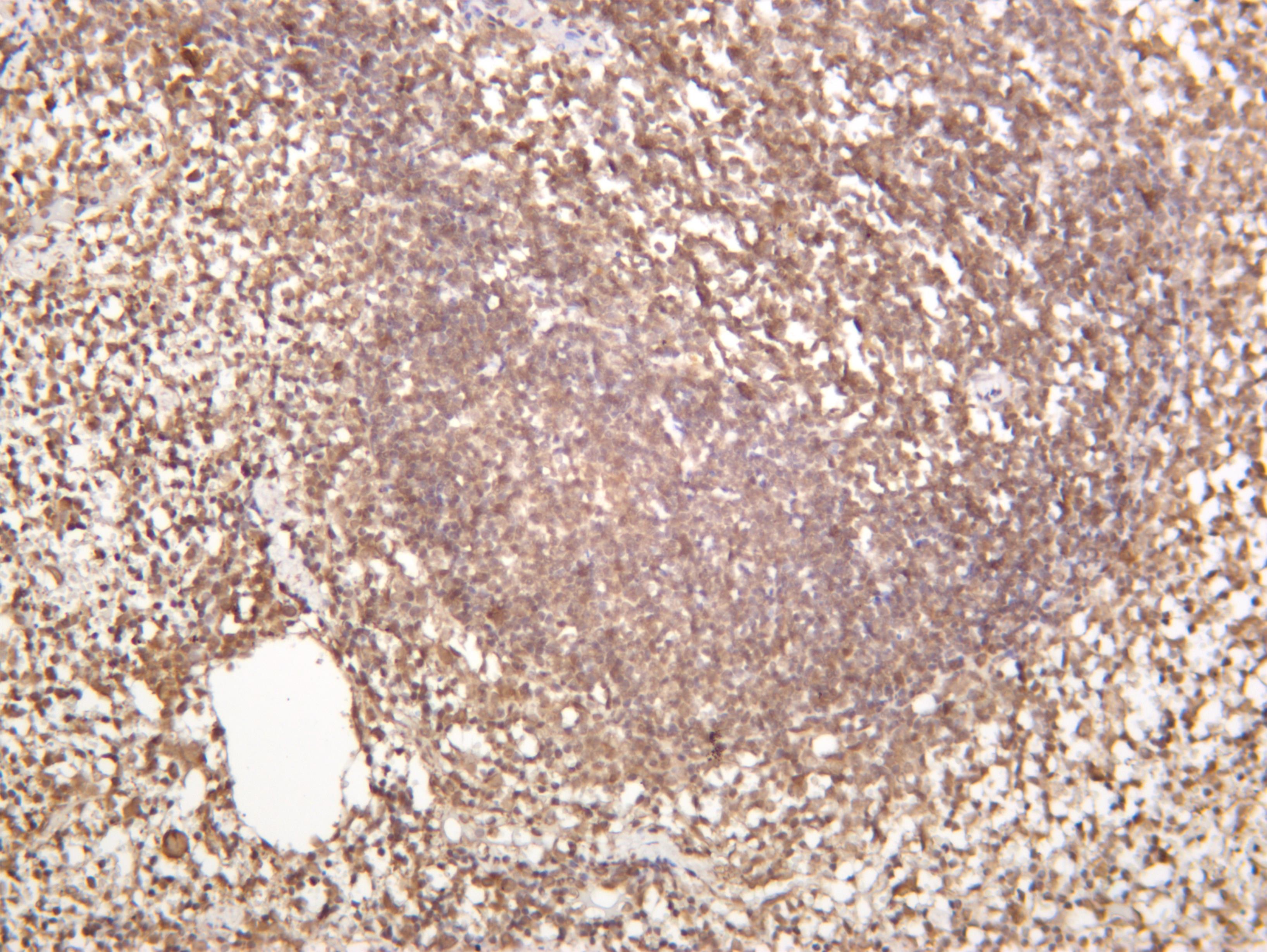 Mouse spleen was stained with anti-Stromal Interaction Molecule 1 (PT0172R) rabbit antibody