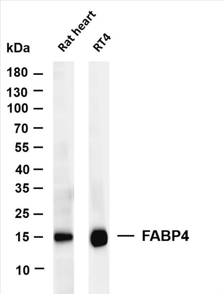 Various whole cell lysates were separated by 4-20% SDS-PAGE, and the membrane was blotted with anti-FABP4 (PT0176R) antibody. The HRP-conjugated Goat anti-Rabbit IgG(H + L) antibody was used to detect the antibody.