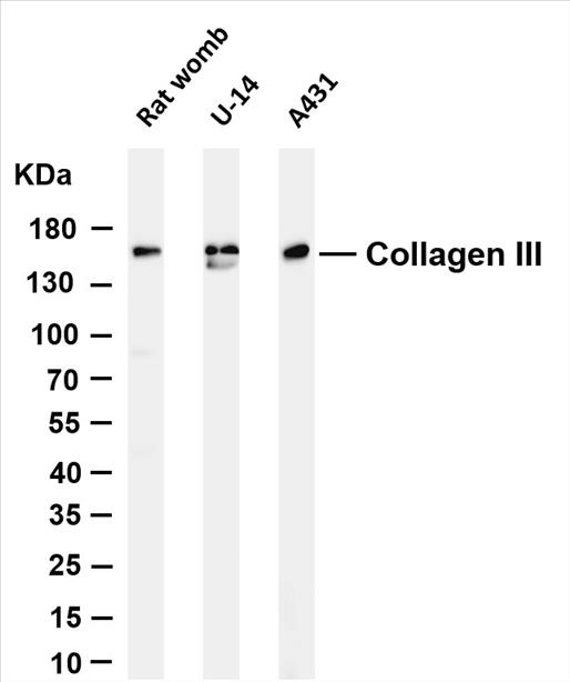 Various whole cell lysates were separated by 4-20% SDS-PAGE, and the membrane was blotted with anti-Collagen III (PT0180R) antibody. The HRP-conjugated Goat anti-Rabbit IgG(H + L) antibody was used to detect the antibody.