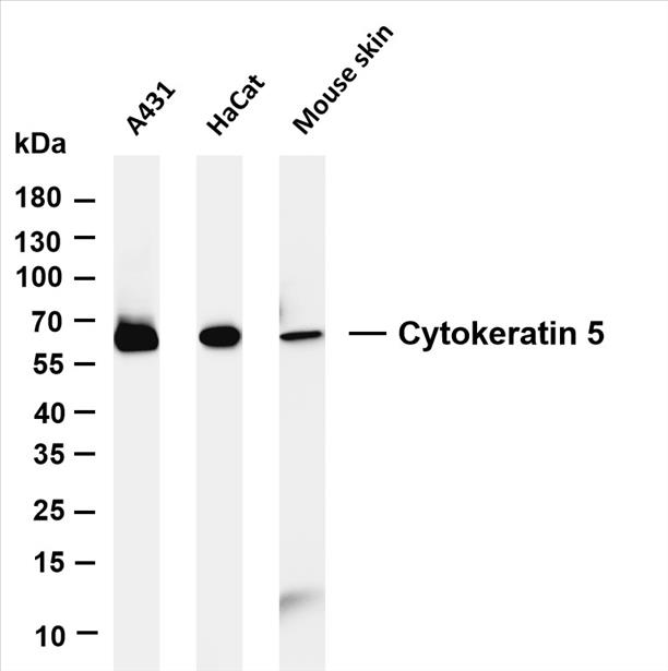 Various whole cell lysates were separated by 4-20% SDS-PAGE, and the membrane was blotted with anti-Cytokeratin 5 (PT0184R) antibody. The HRP-conjugated Goat anti-Rabbit IgG(H + L) antibody was used to detect the antibody.