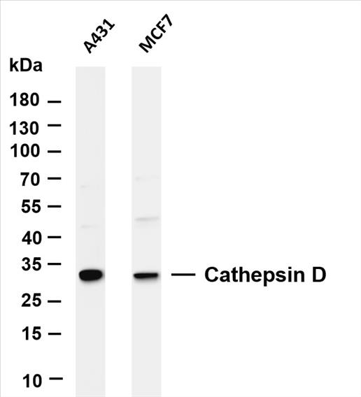 Various whole cell lysates were separated by 4-20% SDS-PAGE, and the membrane was blotted with anti-Cathepsin D (PT0185R) antibody. The HRP-conjugated Goat anti-Rabbit IgG(H + L) antibody was used to detect the antibody.