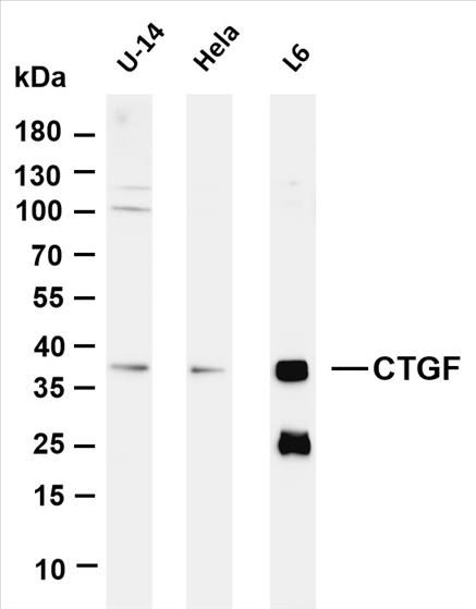 Various whole cell lysates were separated by 4-20% SDS-PAGE, and the membrane was blotted with anti-CTGF (PT0191R) antibody. The HRP-conjugated Goat anti-Rabbit IgG(H + L) antibody was used to detect the antibody.
