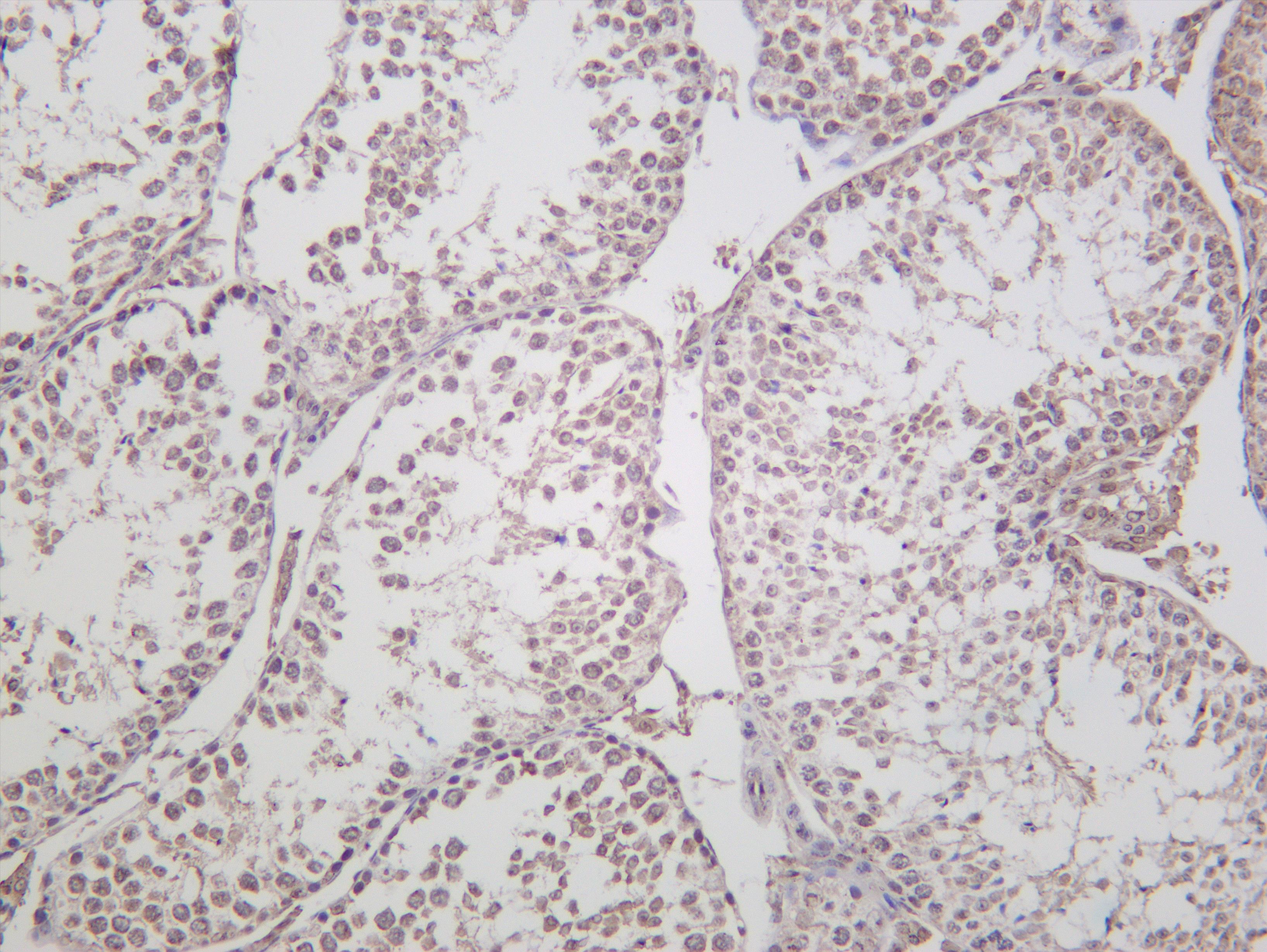 Mouse testis was stained with Anti-Fibrillarin (PT0195R) rabbit antibody
