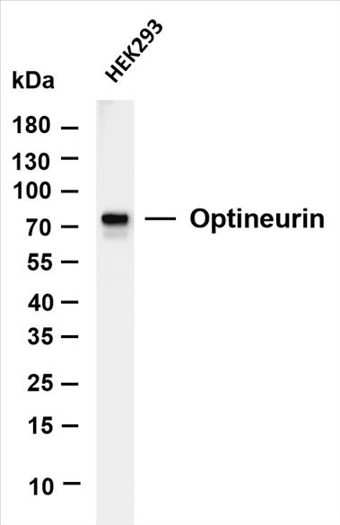 Various whole cell lysates were separated by 4-20% SDS-PAGE, and the membrane was blotted with anti-Optineurin (PT0197R) antibody. The HRP-conjugated Goat anti-Rabbit IgG(H + L) antibody was used to detect the antibody.
