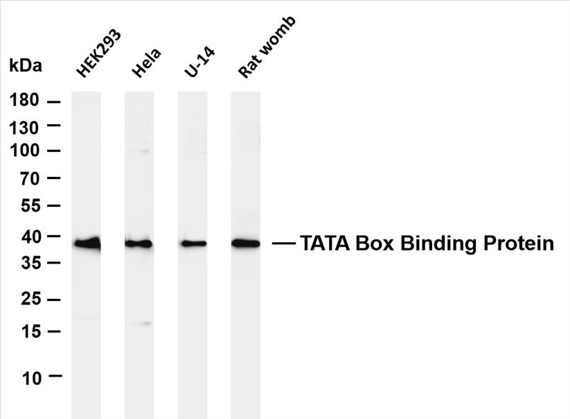 Various whole cell lysates were separated by 4-20% SDS-PAGE, and the membrane was blotted with anti-TATA Box Binding Protein (PT0206R) antibody. The HRP-conjugated Goat anti-Rabbit IgG(H + L) antibody was used to detect the antibody.