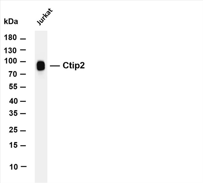 Various whole cell lysates were separated by 4-20% SDS-PAGE, and the membrane was blotted with anti-Ctip2 (PT0207R) antibody. The HRP-conjugated Goat anti-Rabbit IgG(H + L) antibody was used to detect the antibody.