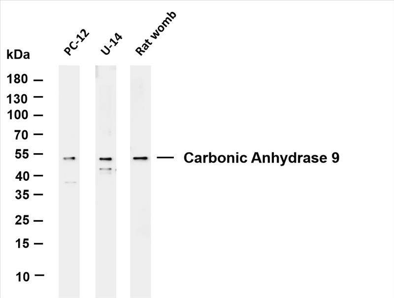 Various whole cell lysates were separated by 4-20% SDS-PAGE, and the membrane was blotted with anti-Carbonic Anhydrase 9 (PT0209R) antibody. The HRP-conjugated Goat anti-Rabbit IgG(H + L) antibody was used to detect the antibody.