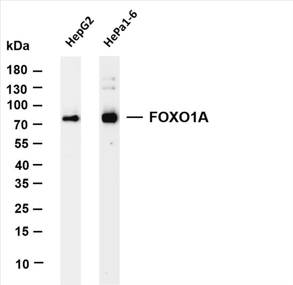 Various whole cell lysates were separated by 4-20% SDS-PAGE, and the membrane was blotted with anti-FOXO1A (PT0213R) antibody. The HRP-conjugated Goat anti-Rabbit IgG(H + L) antibody was used to detect the antibody.