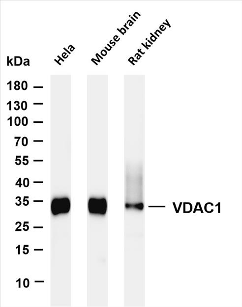 Various whole cell lysates were separated by 4-20% SDS-PAGE, and the membrane was blotted with anti-VDAC1 (PT0214R) antibody. The HRP-conjugated Goat anti-Rabbit IgG(H + L) antibody was used to detect the antibody.