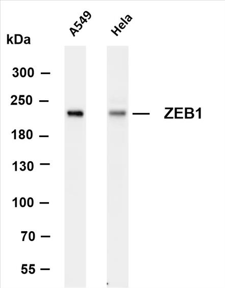 Various whole cell lysates were separated by 4-8% SDS-PAGE, and the membrane was blotted with anti-ZEB1 (PT0216R) antibody. The HRP-conjugated Goat anti-Rabbit IgG(H + L) antibody was used to detect the antibody.