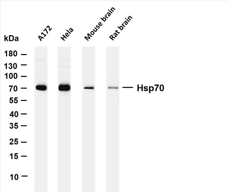 Various whole cell lysates were separated by 4-20% SDS-PAGE, and the membrane was blotted with anti-Hsp70 (PT0218R) antibody. The HRP-conjugated Goat anti-Rabbit IgG(H + L) antibody was used to detect the antibody.