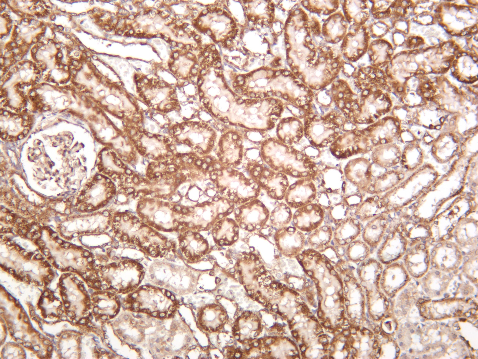 Rat kidney was stained with anti-Bad (PT0219R) rabbit antibody