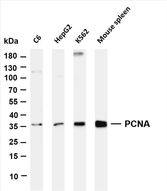 Various whole cell lysates were separated by 4-20% SDS-PAGE, and the membrane was blotted with anti-PCNA (PT0224R) antibody. The HRP-conjugated Goat anti-Rabbit IgG(H + L) antibody was used to detect the antibody.
