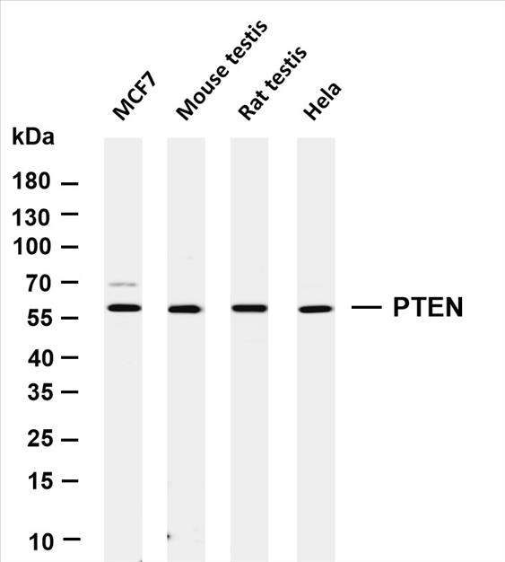 Various whole cell lysates were separated by 4-20% SDS-PAGE, and the membrane was blotted with anti-PTEN (PT0226R) antibody. The HRP-conjugated Goat anti-Rabbit IgG(H + L) antibody was used to detect the antibody.