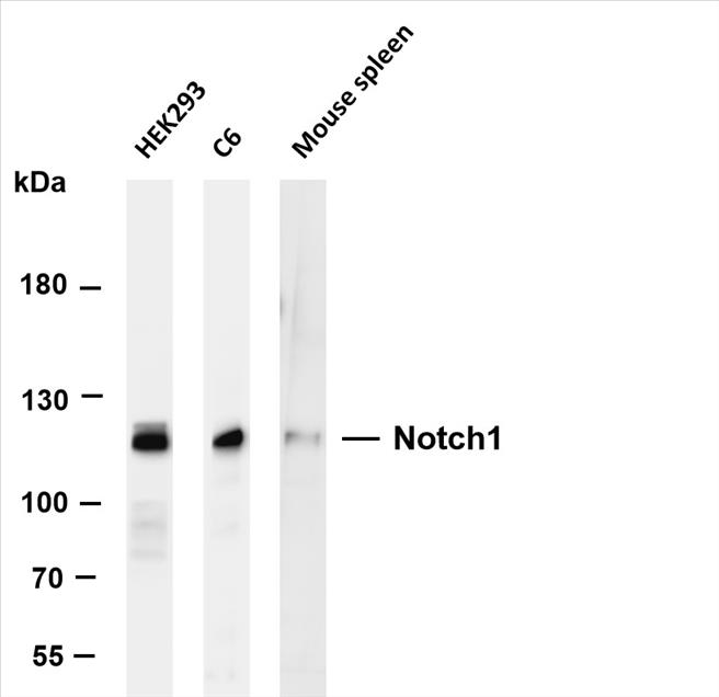 Various whole cell lysates were separated by 6% SDS-PAGE, and the membrane was blotted with anti-Notch1 (PT0229R) antibody. The HRP-conjugated Goat anti-Rabbit IgG(H + L) antibody was used to detect the antibody.