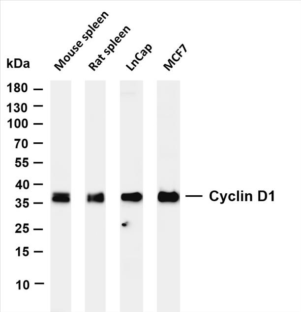 Various whole cell lysates were separated by 4-20% SDS-PAGE, and the membrane was blotted with anti-Cyclin D1 (PT0238R) antibody. The HRP-conjugated Goat anti-Rabbit IgG(H + L) antibody was used to detect the antibody.
