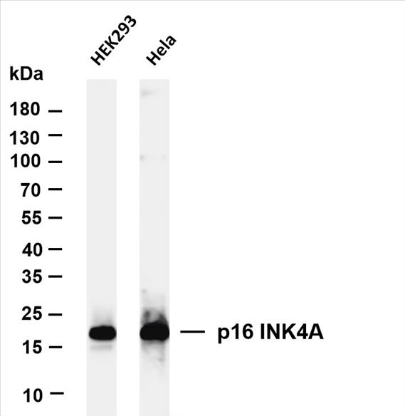 Various whole cell lysates were separated by 4-20% SDS-PAGE, and the membrane was blotted with anti-p16 INK4A (PT0242R) antibody. The HRP-conjugated Goat anti-Rabbit IgG(H + L) antibody was used to detect the antibody.