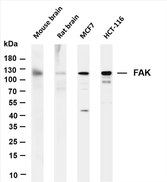 Various whole cell lysates were separated by 4-20% SDS-PAGE, and the membrane was blotted with anti-FAK (PT0245R) antibody. The HRP-conjugated Goat anti-Rabbit IgG(H + L) antibody was used to detect the antibody.