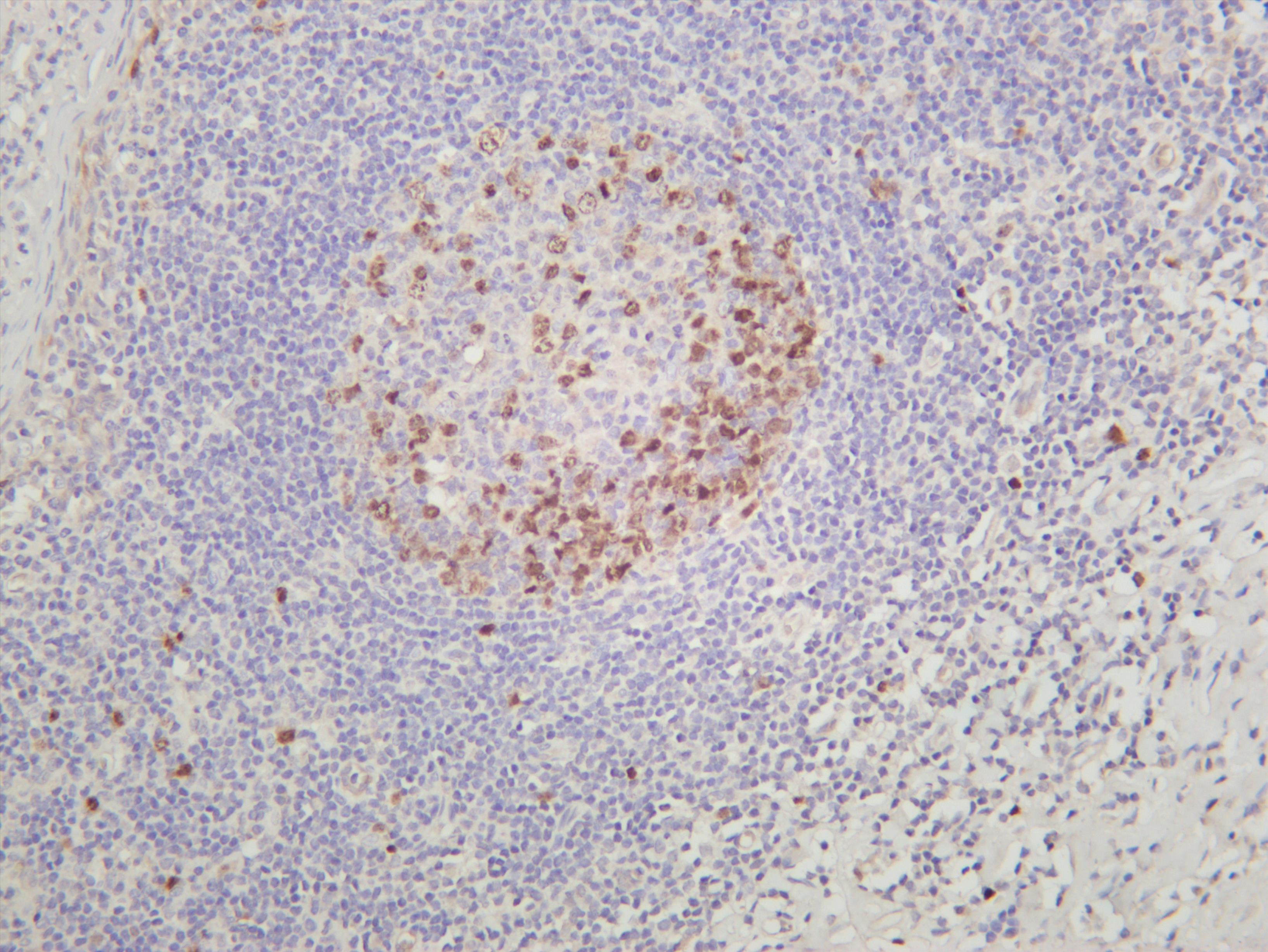Human tonsil was stained with anti-Aurora B (PT0246R) rabbit antibody