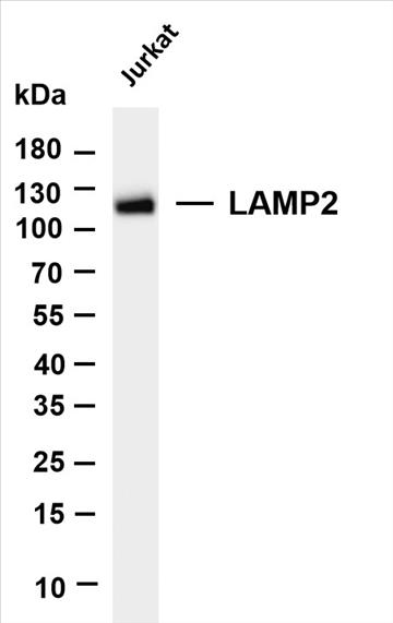 Various whole cell lysates were separated by 4-20% SDS-PAGE, and the membrane was blotted with anti-LAMP2 (PT0249R) antibody. The HRP-conjugated Goat anti-Rabbit IgG(H + L) antibody was used to detect the antibody.