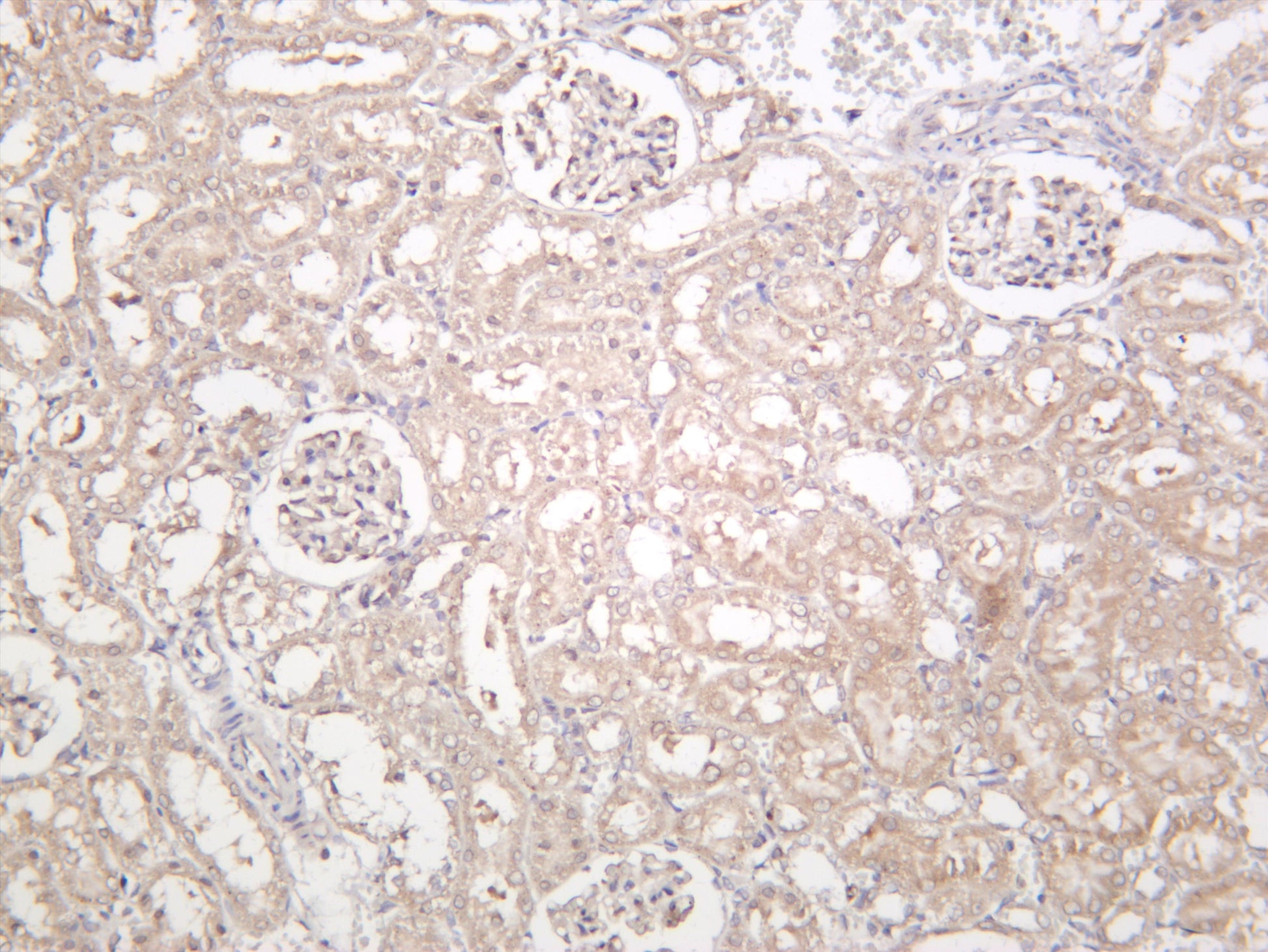 Rat liver was stained with anti-SIRT3 (PT0250R) rabbit antibody