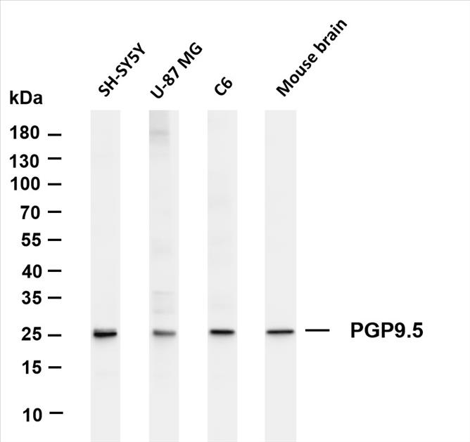 Various whole cell lysates were separated by 4-20% SDS-PAGE, and the membrane was blotted with anti-PGP9.5 (PT0253R) antibody. The HRP-conjugated Goat anti-Rabbit IgG(H + L) antibody was used to detect the antibody.