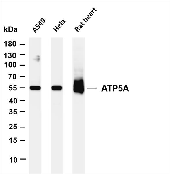 Various whole cell lysates were separated by 4-20% SDS-PAGE, and the membrane was blotted with anti-ATP5A (PT0255R) antibody. The HRP-conjugated Goat anti-Rabbit IgG(H + L) antibody was used to detect the antibody.