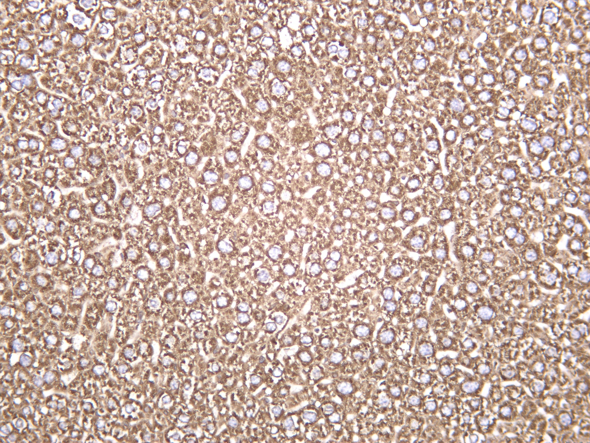 Mouse liver was stained with anti-Calreticulin (PT0256R) rabbit antibody