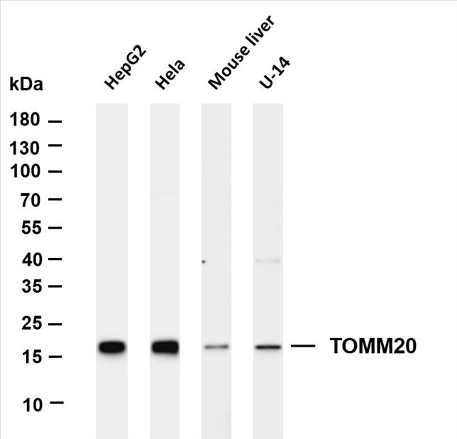 Various whole cell lysates were separated by 4-20% SDS-PAGE, and the membrane was blotted with anti-TOMM20 (PT0287R) antibody. The HRP-conjugated Goat anti-Rabbit IgG(H + L) antibody was used to detect the antibody.