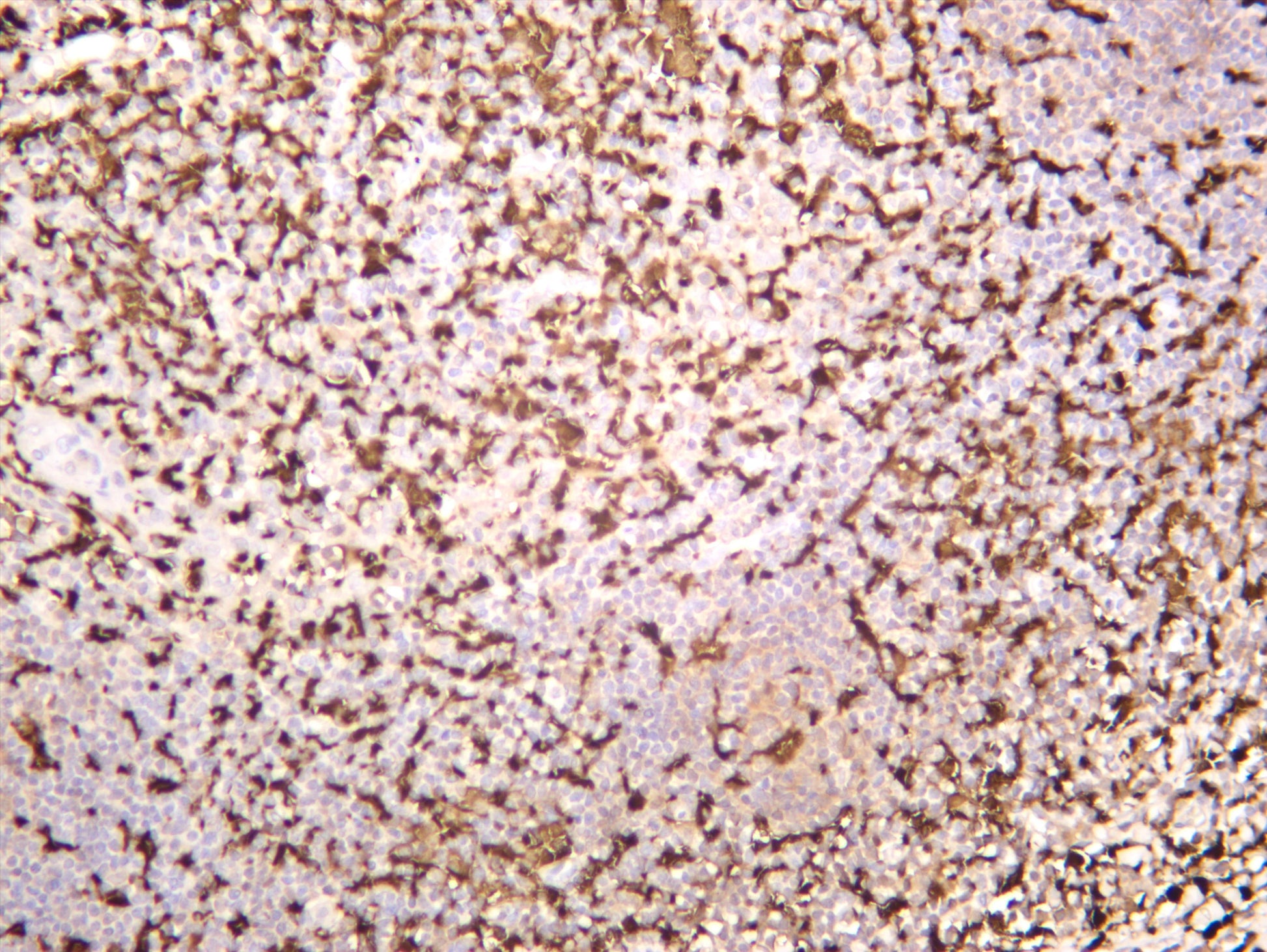 Human tonsil was stained with anti-Iba1 (PT0288R) rabbit antibody