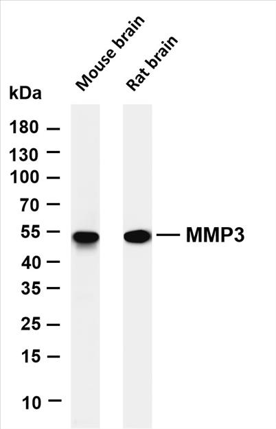 Various whole cell lysates were separated by 4-20% SDS-PAGE, and the membrane was blotted with anti-MMP3 (PT0292R) antibody. The HRP-conjugated Goat anti-Rabbit IgG(H + L) antibody was used to detect the antibody.