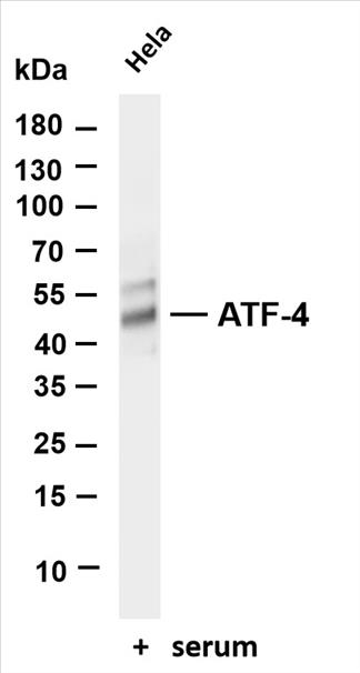 Various whole cell lysates were separated by 4-20% SDS-PAGE, and the membrane was blotted with anti-ATF-4 (PT0294R) antibody. The HRP-conjugated Goat anti-Rabbit IgG(H + L) antibody was used to detect the antibody.