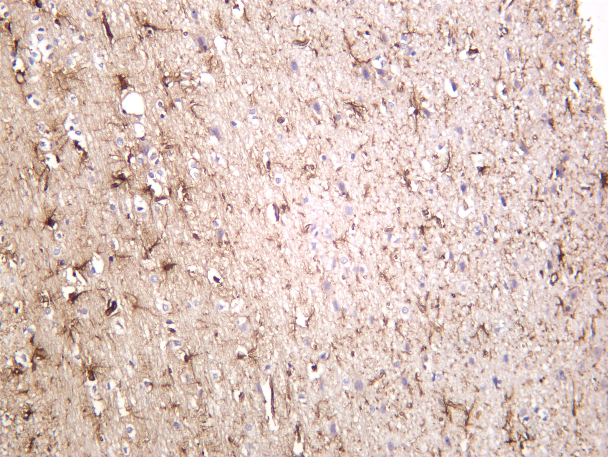 Rat brain was stained with anti-GFAP (PT0298R) rabbit antibody