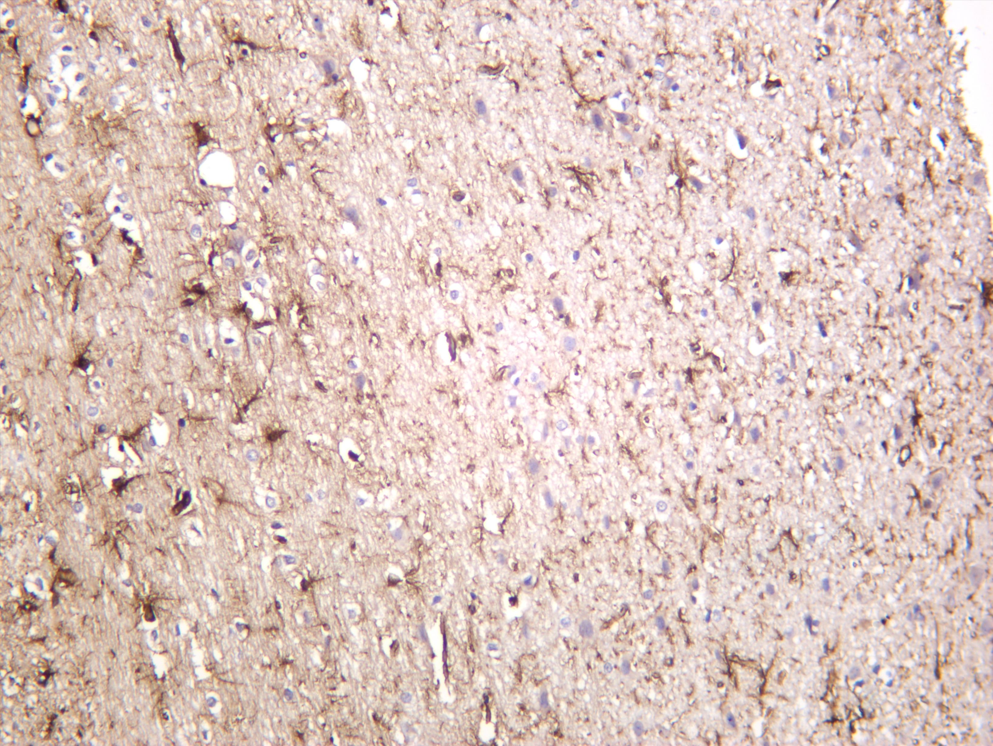 Rat brain was stained with anti-GFAP (PT0298R) rabbit antibody