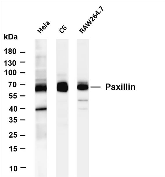 Various whole cell lysates were separated by 4-20% SDS-PAGE, and the membrane was blotted with anti-Paxillin (PT0303R) antibody. The HRP-conjugated Goat anti-Rabbit IgG(H + L) antibody was used to detect the antibody.