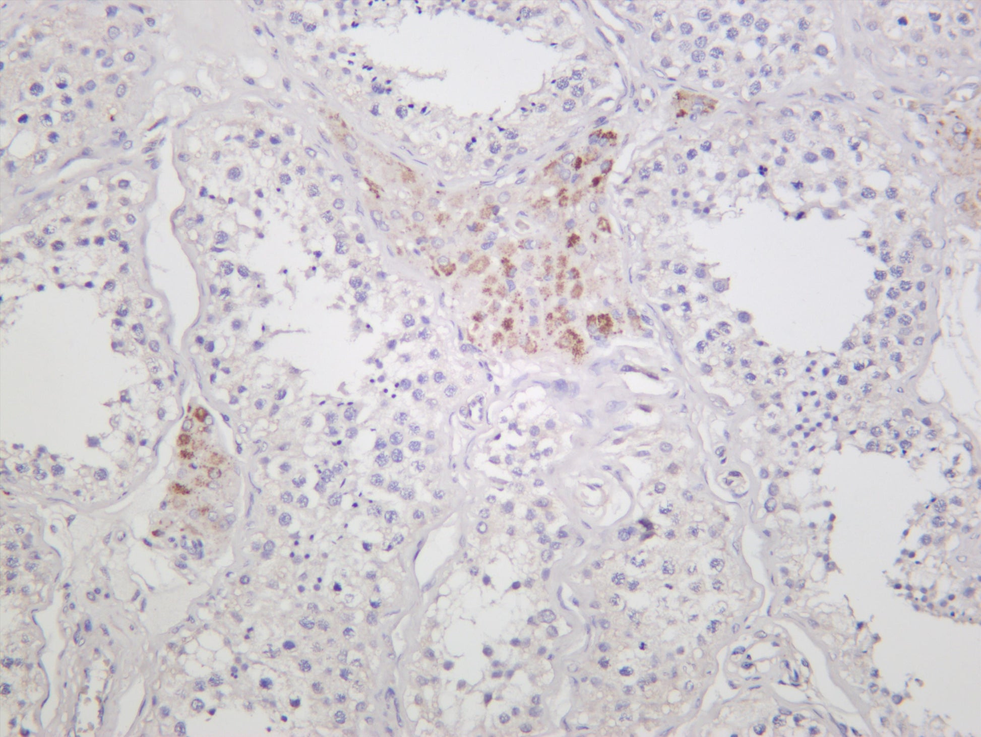 Human testis was stained with anti-ROCK1 (PT0305R) rabbit antibody