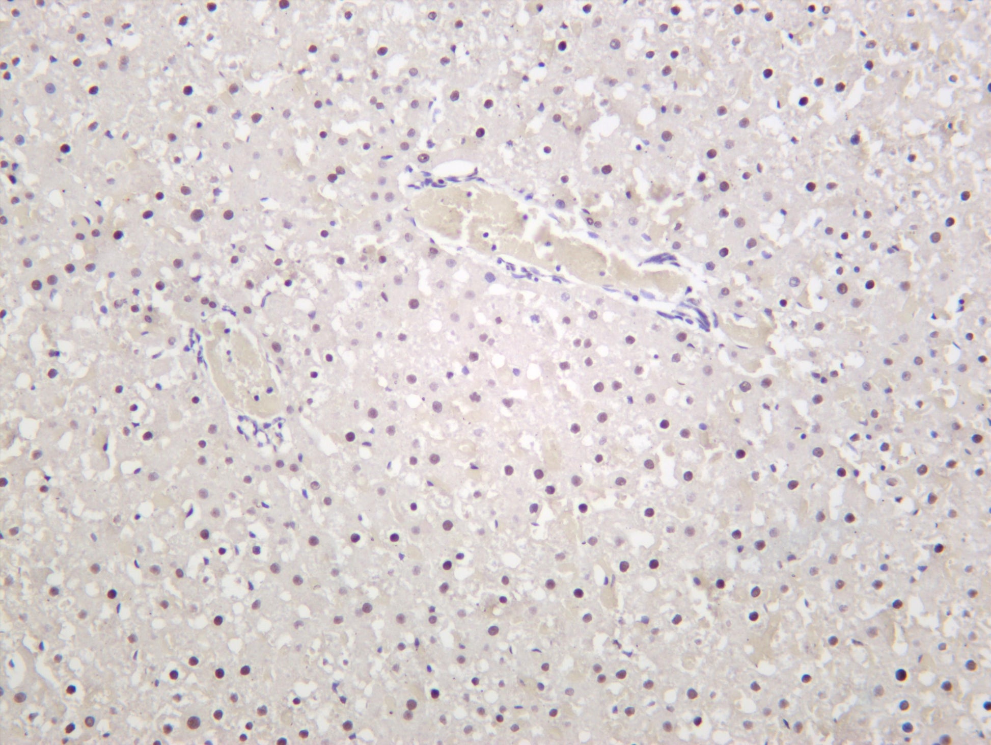 Rat liver was stained with anti-Glucocorticoid Receptor (PT0306R) rabbit antibody
