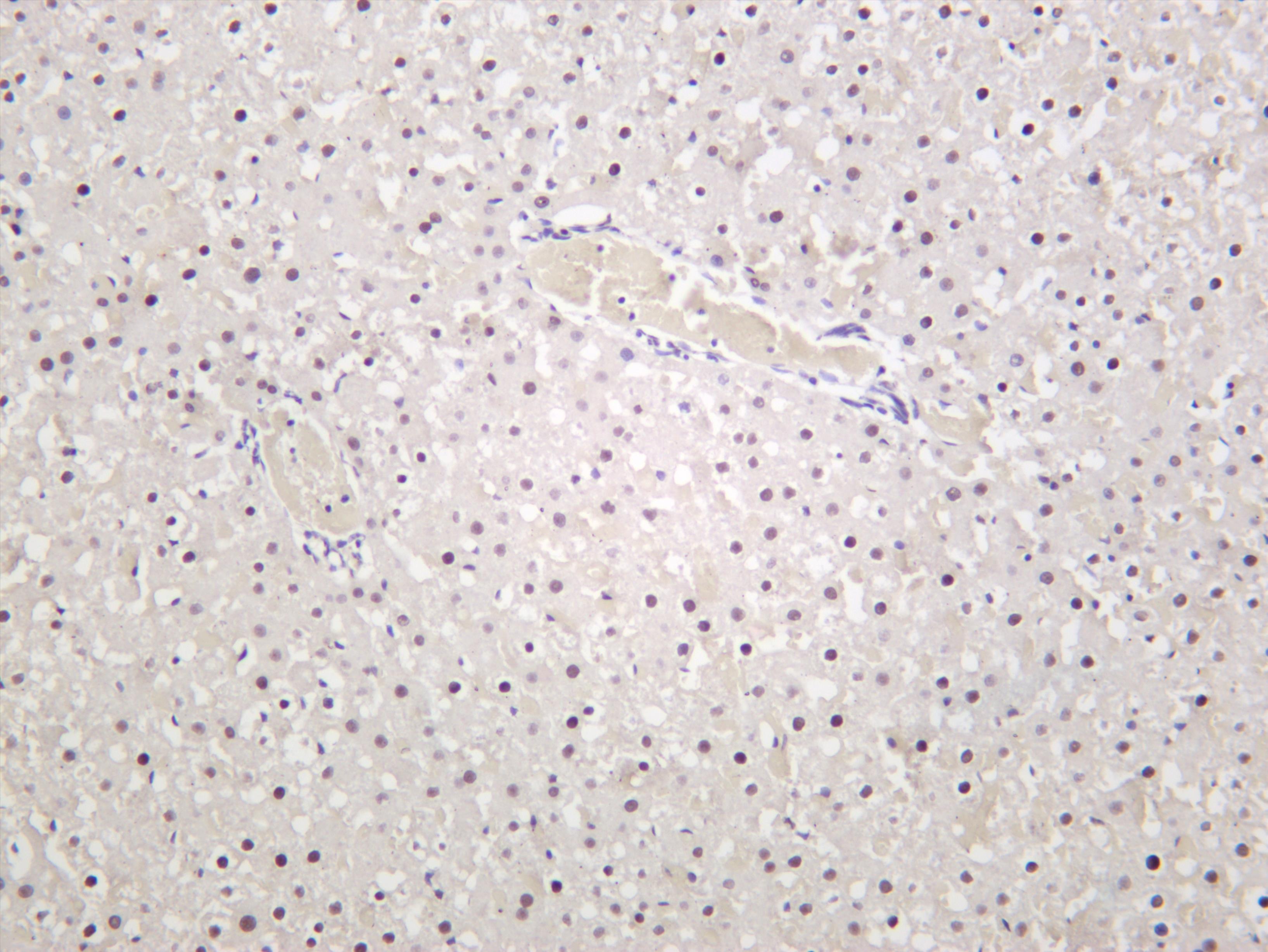 Rat liver was stained with anti-Glucocorticoid Receptor (PT0306R) rabbit antibody