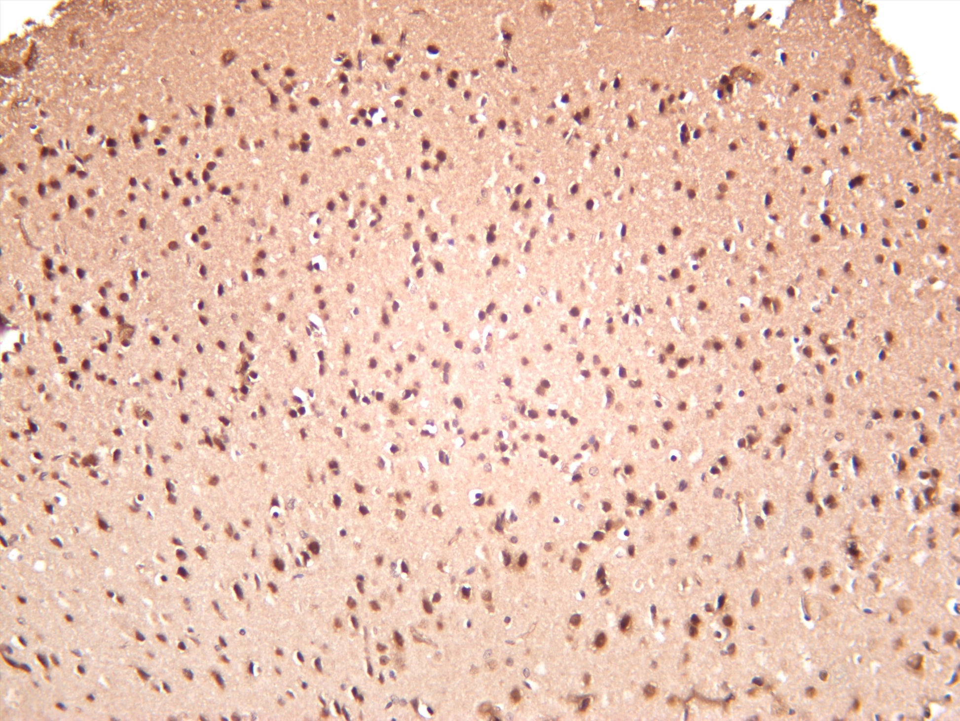 Mouse brain was stained with anti-TLS/FUS (PT0308R) rabbit antibody