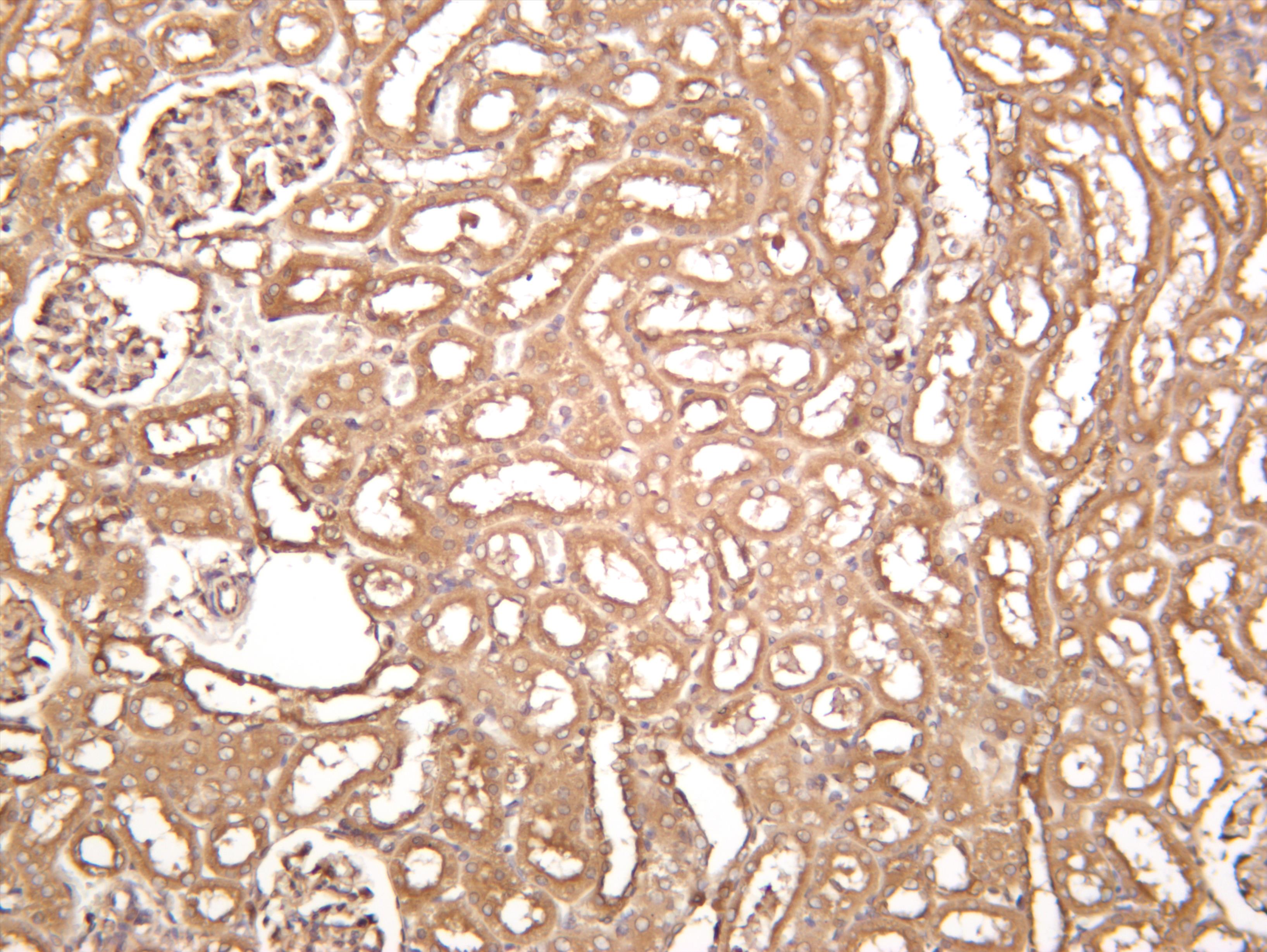 Rat kidney was stained with anti-Rab 5A (PT0309R) rabbit antibody