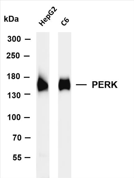 Various whole cell lysates were separated by 4-8% SDS-PAGE, and the membrane was blotted with anti-PERK (PT0310R) antibody. The HRP-conjugated Goat anti-Rabbit IgG(H + L) antibody was used to detect the antibody.