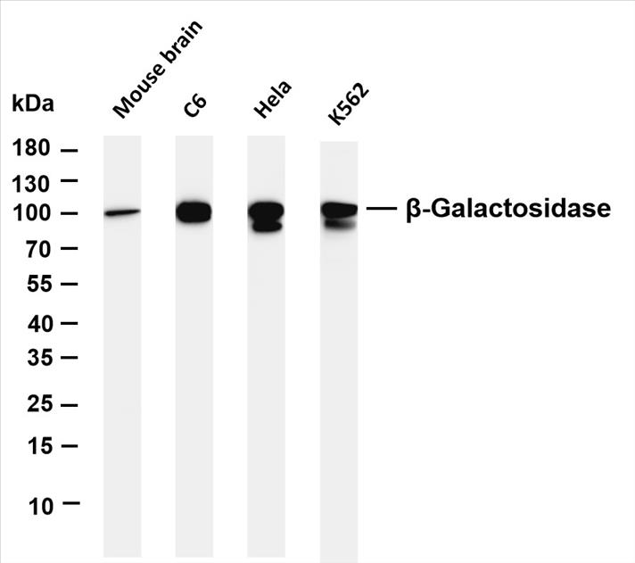 Various whole cell lysates were separated by 4-20% SDS-PAGE, and the membrane was blotted with anti-Î²-Galactosidase (PT0312R) antibody. The HRP-conjugated Goat anti-Rabbit IgG(H + L) antibody was used to detect the antibody.